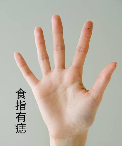 在手相学中,大拇指的痣代表一个人的事业运势.