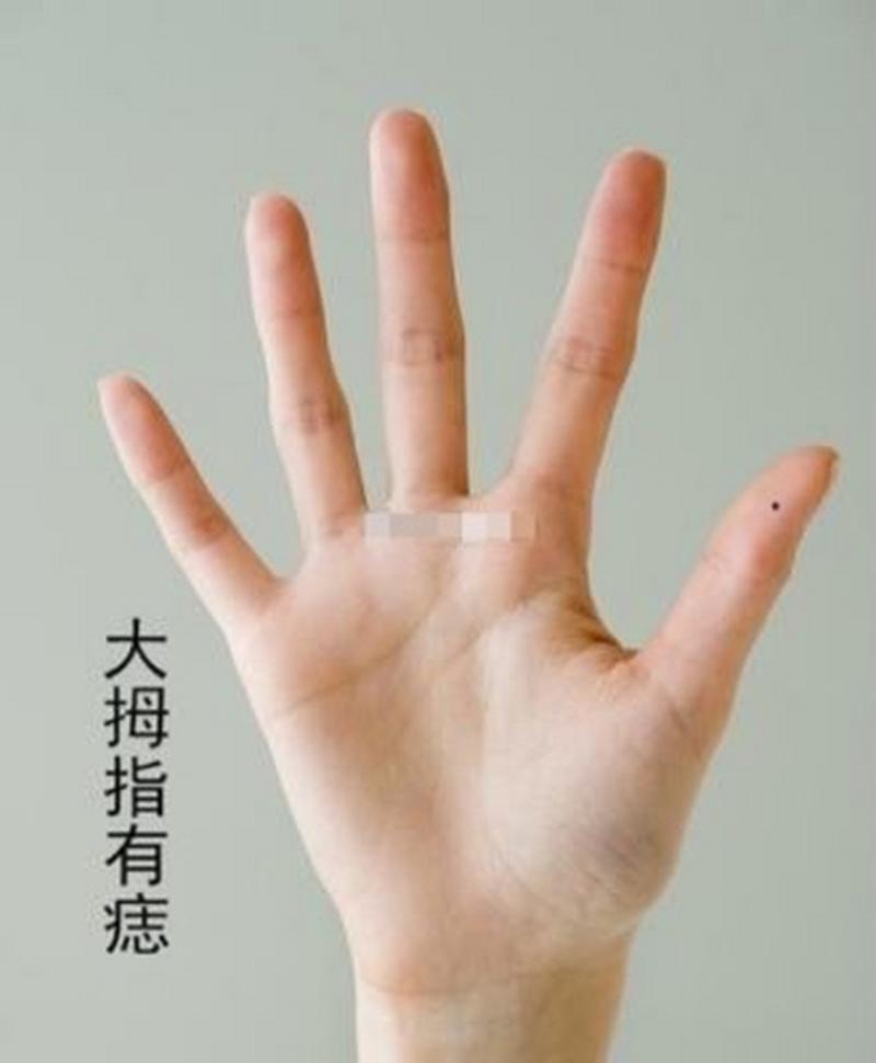 大拇指在手相学当中主父母长辈,而生在大拇指上的痣属于比较的少见