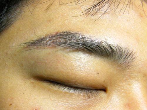 眉头有疤的面相怎么样眉毛有疤痕对运程如何影响